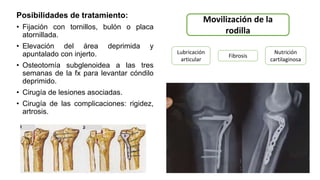 Posibilidades de tratamiento:
• Fijación con tornillos, bulón o placa
atornillada.
• Elevación del área deprimida y
apuntalado con injerto.
• Osteotomía subglenoidea a las tres
semanas de la fx para levantar cóndilo
deprimido.
• Cirugía de lesiones asociadas.
• Cirugía de las complicaciones: rigidez,
artrosis.
Movilización de la
rodilla
Lubricación
articular
Nutrición
cartilaginosa
Fibrosis
 
