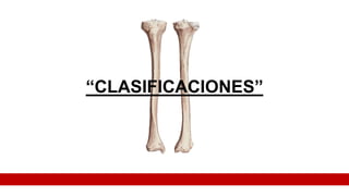 “CLASIFICACIONES”
 