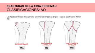 FRACTURAS DE LA TIBIA PROXIMAL:
CLASIFICACIONES: AO
Las fracturas tibiales del segmento proximal se dividen en 3 tipos según la clasificación Müller
AO:
EXTRAARTICULAR
41A
PARCIALMENTE
ARTICULAR
41B
COMPLETAMENTE
ARTICULAR
41C
 