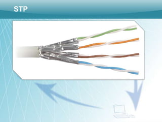 STP
 