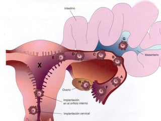  se utiliza  la ecografia  transvaginal  (ecografia endovaginal) para medir el diametro del saco corionicoEl embrion de 14 dias de edad tiene todavia forma de disco embrionario 