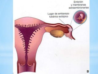 LUGARES DE IMPLANTACION DEL BLASTOCITOLa implantación de un blastocito se puede detectas mediante ecografía  y pruebas  radioinmunologicas. 