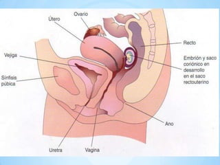 IMPLANTACIONEXTRAUTERINA Los blastocitos se pueden implantar fuera del utero. Tales implantaciones producen embarazos etopicos. 