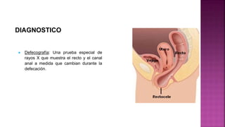 DIAGNOSTICO
 Defecografía: Una prueba especial de
rayos X que muestra el recto y el canal
anal a medida que cambian durante la
defecación.
 