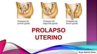 Bryan Beltrán Panta
 