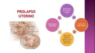 Protrusión
del útero y
vagina
Fuera de
este órgano
Músculos
delsuelo
pélvico y los
ligamentos
seestiran
Desciende o
Sobresale
 
