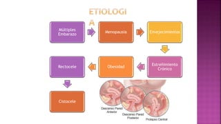 Múltiples
Embarazo
Menopausia Envejecimientos
Estreñimiento
Crónico
ObesidadRectocele
Cistocele
 