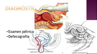 •Examen pélvico
•Defecografia
 