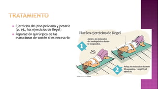 Ejercicios del piso pelviano y pesario
(p. ej., los ejercicios de Kegel)
 Reparación quirúrgica de las
estructuras de sostén si es necesario
 