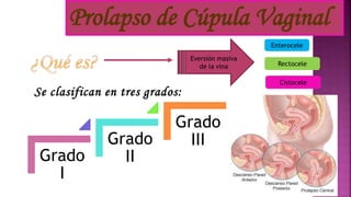 Eversión masiva
de la vina
Enterocele
Rectocele
Cistocele
Se clasifican en tres grados:
Grado
I
Grado
II
Grado
III
Prolapso de Cúpula Vaginal
 