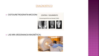  CISTOURETROGRAFÍA MICCIONAL
 LAS MRI (RESONANCIA MAGNÉTICA)
 