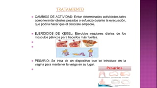  CAMBIOS DE ACTIVIDAD: Evitar determinadas actividades,tales
como levantar objetos pesados o esfuerzo durante la evacuación,
que podría hacer que el cistocele empeore.
 EJERCICIOS DE KEGEL: Ejercicios regulares diarios de los
músculos pélvicos para hacerlos más fuertes.


 PESARIO: Se trata de un dispositivo que se introduce en la
vagina para mantener la vejiga en su lugar.

 