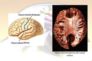 Fibras interhemisféricas del cuerpo calloso. 