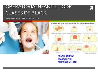 OPERATORIA INFANTIL. ODP
CLASES DE BLACK
LESIONES DE CLASE I-II-III-IV-V-VI
FANNY BARONE
MARCO LENZI
FEDERICO VILLANI
 