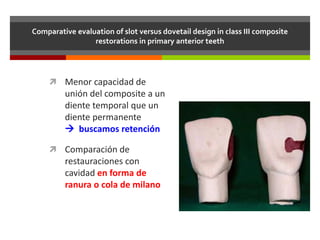 Comparative evaluation of slot versus dovetail design in class III composite
restorations in primary anterior teeth
 Menor capacidad de
unión del composite a un
diente temporal que un
diente permanente
 buscamos retención
 Comparación de
restauraciones con
cavidad en forma de
ranura o cola de milano
 