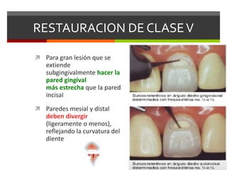 RESTAURACION DE CLASEV
 Para gran lesión que se
extiende
subgingivalmente hacer la
pared gingival
más estrecha que la pared
incisal
 Paredes mesial y distal
deben divergir
(ligeramente o menos),
reflejando la curvatura del
diente
 