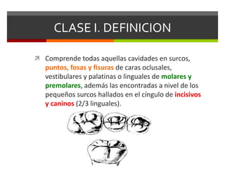 CLASE I. DEFINICION
 Comprende todas aquellas cavidades en surcos,
puntos, fosas y fisuras de caras oclusales,
vestibulares y palatinas o linguales de molares y
premolares, además las encontradas a nivel de los
pequeños surcos hallados en el cíngulo de incisivos
y caninos (2/3 linguales).
 