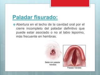 Paladar fisurado:
 Abertura en el techo de la cavidad oral por el
cierre incompleto del paladar definitivo que
puede estar asociado o no al labio leporino,
más frecuente en hembras.
 