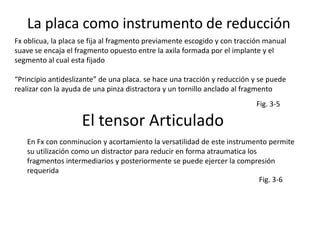 Permitir una movilización activa e inmediata de los musc. y art. de la región fracturada 