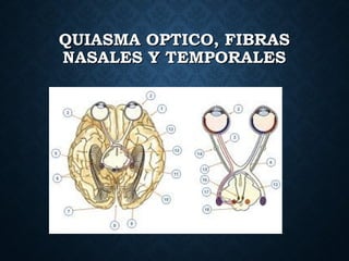 QUIASMA OPTICO, FIBRASQUIASMA OPTICO, FIBRAS
NASALES Y TEMPORALESNASALES Y TEMPORALES
 