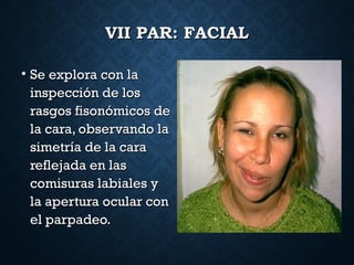 VII PAR: FACIALVII PAR: FACIAL
• Se explora con laSe explora con la
inspección de losinspección de los
rasgos fisonómicos derasgos fisonómicos de
la cara, observando lala cara, observando la
simetría de la carasimetría de la cara
reflejada en lasreflejada en las
comisuras labiales ycomisuras labiales y
la apertura ocular conla apertura ocular con
el parpadeo.el parpadeo.
 