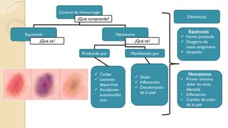 Control de Hemorragia
¿Qué comprende?
Equimosis Hematoma
¿Qué es?¿Qué es?
Producido por
 Caídas
 Lesiones
deportivas
 Accidentes
automovilíst
icos
Manifestado por
 Dolor
 Inflamación
 Decoloración
de la piel
Diferencias
Equimosis
 Forma punteada
 Desgarro de
vasos sanguíneos
 chupetón
Hematoma
• Primer síntoma
dolor en zona
afectada
• Inflamación
• Cambio de color
de la piel
 