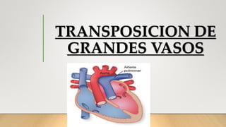 TRANSPOSICION DE
GRANDES VASOS
 