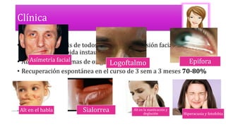 Clínica
• Paresia o parálisis de todos los M de la expresión facial de un solo
lado, con una rápida instauración < 72 hrs
• Ausencia de síntomas de origen central
• Recuperación espontánea en el curso de 3 sem a 3 meses 70-80%
Asímetría facial
Logoftalmo Epifora
Alt en el habla Sialorrea Alt en la masticación y
deglución Hiperacusia y fotofobia
 