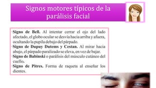 Signos motores típicos de la
parálisis facial
 