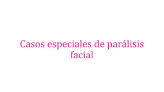 Casos especiales de parálisis
facial
 