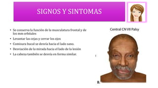 SIGNOS Y SINTOMAS
• Se conserva la función de la musculatura frontal y de
los mm orbitales
• Levantar las cejas y cerrar los ojos
• Comisura bucal se desvía hacia el lado sano.
• Desviación de la mirada hacia el lado de la lesión
• La cabeza también se desvía en forma similar.
 