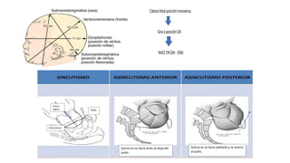 Cabezafetalposicióntransversa
GiraaposiciónOA
NACEENOAI-OAD
Sutura
sagital
Promontorio
Pubis
Sutura se va hacia atrás se aleja del
pubis .
Sutura se va hacia adelante y se acerca
al pubis.
 
