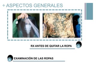 + ASPECTOS GENERALES
1

ACTA DE PROCEDIMIENTO
SUMARIO DE INVESTIGACIÓN

3

EXAMINACIÓN DEL CUERPO VESTIDO

RX ANTES DE QUITAR LA ROPA

5

2

EXAMINACIÓN DE LAS ROPAS

4

 