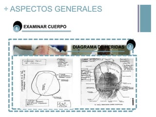 + ASPECTOS GENERALES
6

EXAMINAR CUERPO

DIAGRAMA DE HERIDAS

7

 