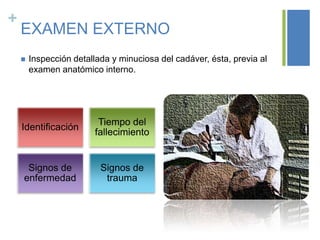 +

EXAMEN EXTERNO


Inspección detallada y minuciosa del cadáver, ésta, previa al
examen anatómico interno.

Identificación

Tiempo del
fallecimiento

Signos de
enfermedad

Signos de
trauma

 