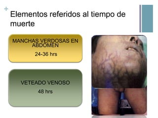 +

Elementos referidos al tiempo de
muerte
RIGIDEZ
GRADO DE ENFRIAMIENTO
MANCHAS VERDOSAS EN
“rigoris mortis”
“algor mortis”
ABDOMEN

1ºC x 3-4 12 primeras horas
hr hrs comienzo
12-15 hrs completo
0.5º x24 hrs desaparecehoras
hr 24-36 hrs
12 segundas

SIGNOS DE DESHIDRATACIÓN
LIVIDECES
“livor moros”
VETEADO 45 min (abierto) y
STENON – LOUIS VENOSO
24 hrs (cerrado)
30min - 3hrs

48 (abierto) y 24 hrs
SOMMER 3-5 hrshrs
(cerrado)

 