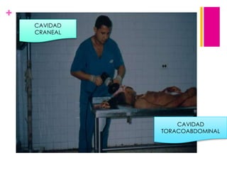 +
CAVIDAD
CRANEAL

CAVIDAD
TORACOABDOMINAL

 
