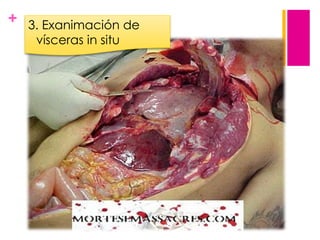 +

3. Exanimación de
vísceras in situ

 