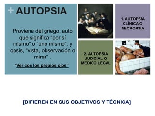 + AUTOPSIA
Proviene del griego, auto
que significa “por sí
mismo” o “uno mismo”, y
opsis, “vista, observación o
mirar” .
“Ver con los propios ojos”

1. AUTOPSIA
CLÍNICA O
NECROPSIA

2. AUTOPSIA
JUDICIAL O
MEDICO LEGAL

[DIFIEREN EN SUS OBJETIVOS Y TÉCNICA]

 