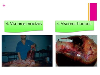 +

4. Vísceras macizas

4. Vísceras huecas

 