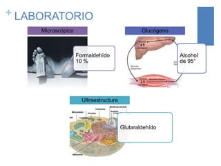 + LABORATORIO
Microscópico

Glucógeno

Formaldehído
10 %

Alcohol
de 95°

Ultraestructura

Glutaraldehído

 