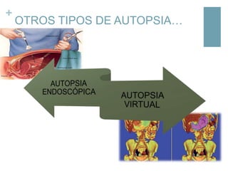 +

OTROS TIPOS DE AUTOPSIA…

 