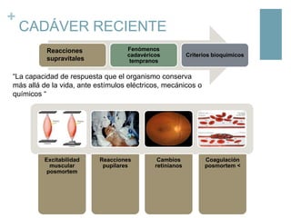 +

CADÁVER RECIENTE
Reacciones
supravitales

Fenómenos
cadavéricos
tempranos

Criterios bioquímicos

“La capacidad de respuesta que el organismo conserva
más allá de la vida, ante estímulos eléctricos, mecánicos o
químicos “

Excitabilidad
muscular
posmortem

Reacciones
pupilares

Cambios
retinianos

Coagulación
posmortem <

 