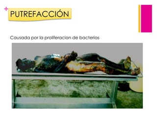+

PUTREFACCIÓN
Causada por la proliferacion de bacterias

 