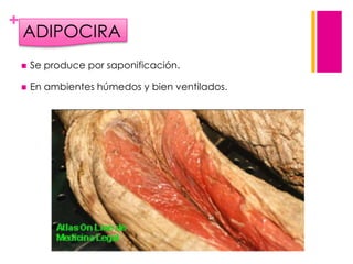 +

ADIPOCIRA


Se produce por saponificación.



En ambientes húmedos y bien ventilados.

 