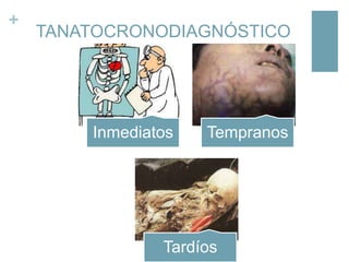 +

TANATOCRONODIAGNÓSTICO

Inmediatos

Tempranos

Tardíos

 