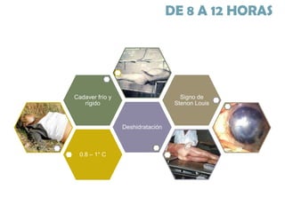 DE 8 A 12 HORAS

Signo de
Stenon Louis

Cadaver frío y
rígido

Deshidratación

0.8 – 1° C

 