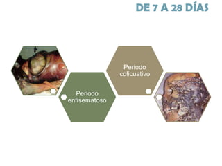 DE 7 A 28 DÍAS

Periodo
colicuativo
Periodo
enfisematoso

 
