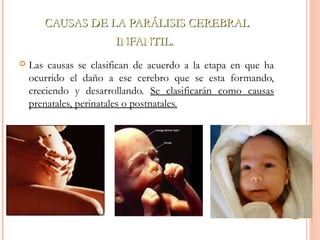 CAUSAS DE LLAA PPAARRÁÁLLIISSIISS CCEERREEBBRRAALL 
IINNFFAANNTTIILL.. 
 Las causas se clasifican de acuerdo a la etapa en que ha 
ocurrido el daño a ese cerebro que se esta formando, 
creciendo y desarrollando. Se clasificarán como causas 
prenatales, perinatales o postnatales. 
 