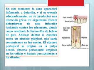 Expo abscesos | PPTX